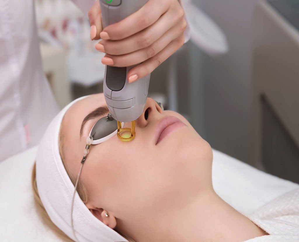Laser Treatment